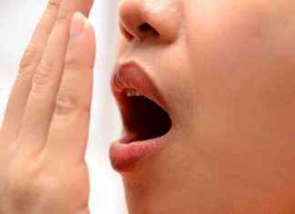 Avoid Bad Breath During Ramadan Fasting | Helpful Tips avoid-bad-breath-during-ramadan-fasting-helpful-tips